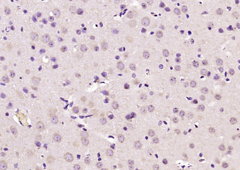 Chromogranin A antibody