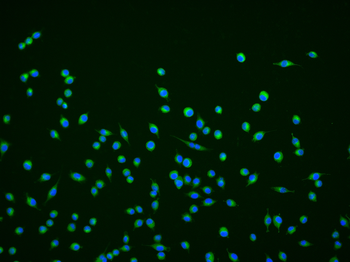 Chromogranin A antibody