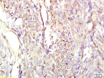 Chromogranin A antibody