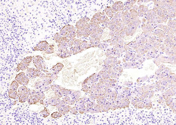 Chromogranin B antibody