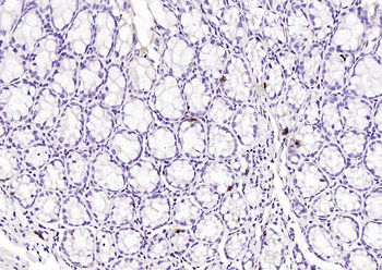 Chromogranin B antibody