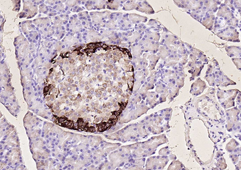 Chromogranin B antibody