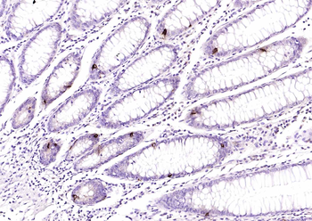 Chromogranin B antibody