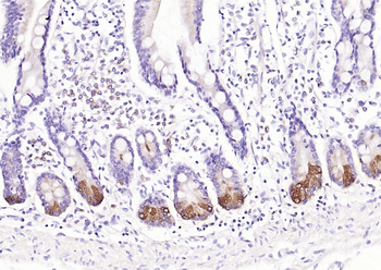 Chromogranin B antibody