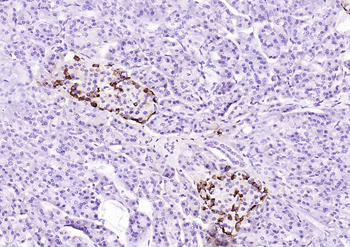 Chromogranin B antibody