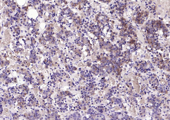 Chromogranin B antibody