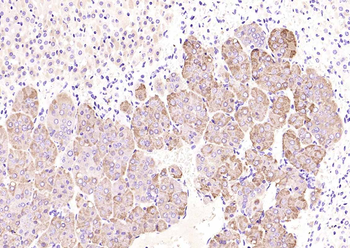 Chromogranin B antibody