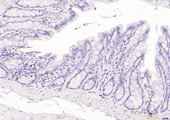 Chromogranin B antibody