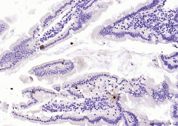 Chromogranin B antibody