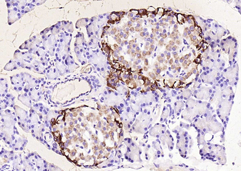 Chromogranin B antibody