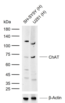 Chat antibody