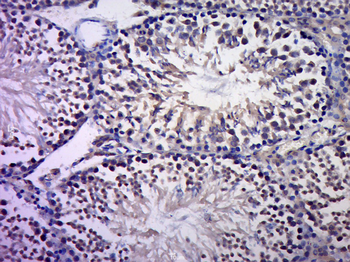 c-Jun antibody