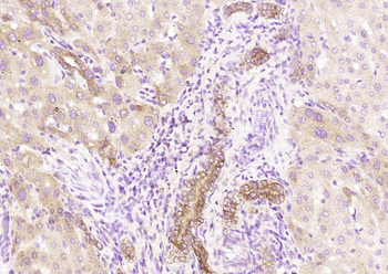 pan Cytokeratin antibody