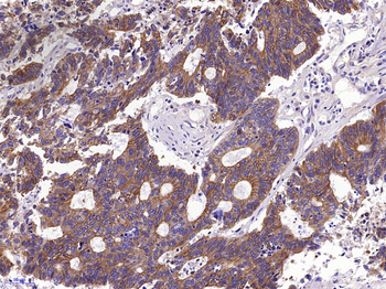 pan Cytokeratin antibody