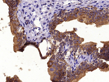 pan Cytokeratin antibody