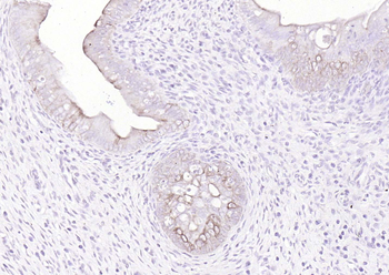 pan Cytokeratin antibody