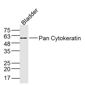 pan Cytokeratin antibody