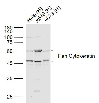 pan Cytokeratin antibody