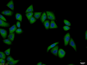 pan Cytokeratin antibody