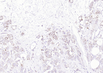 pan Cytokeratin antibody