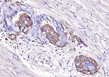 pan Cytokeratin antibody