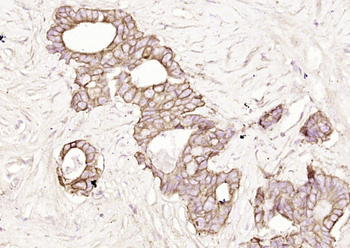 pan Cytokeratin antibody