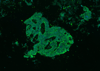 pan Cytokeratin antibody