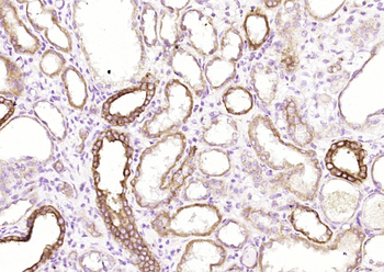 pan Cytokeratin antibody