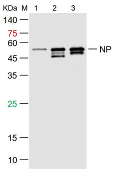 SARS-CoV-2 (2019-nCoV) Nucleocapsid antibody