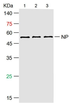 SARS-CoV-2 (2019-nCoV) Nucleocapsid antibody