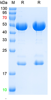 SARS-CoV-2 (2019-nCoV) Nucleocapsid antibody