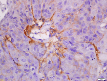 Cytokeratin 7 antibody