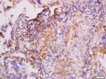 Cytokeratin 7 antibody