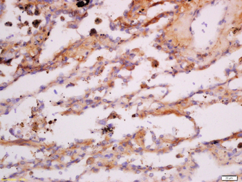 Cytokeratin 7 antibody