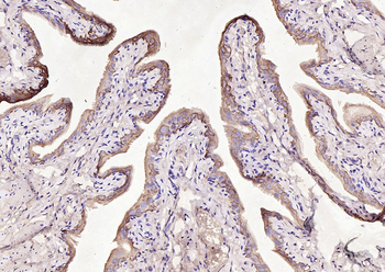 Cytokeratin 7 antibody