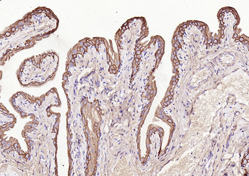 Cytokeratin 7 antibody