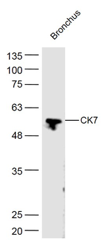 Cytokeratin 7 antibody