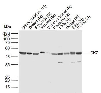 Cytokeratin 7 antibody