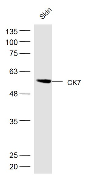 Cytokeratin 7 antibody