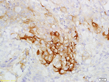 Cytokeratin 7 antibody