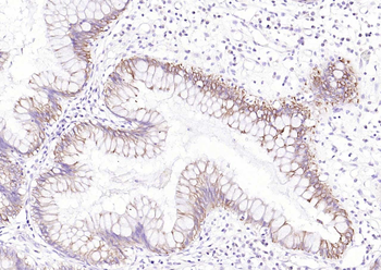 Cytokeratin 8 antibody