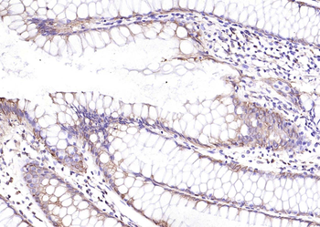 Cytokeratin 8 antibody