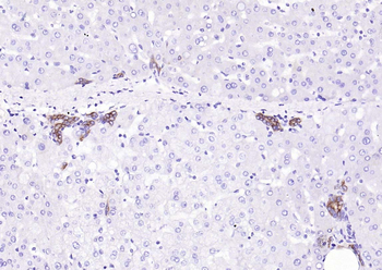 Cytokeratin 8 antibody