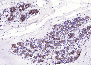 Cytokeratin 8 antibody