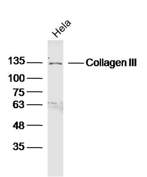 Collagen III Rabbit Polyclonal Antibody