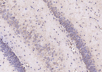 CRF antibody