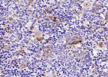 GP1BA antibody