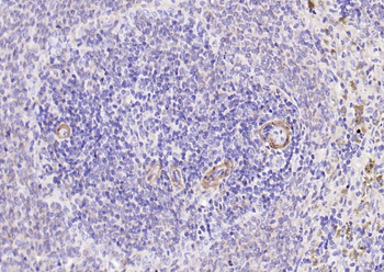 GP1BA antibody