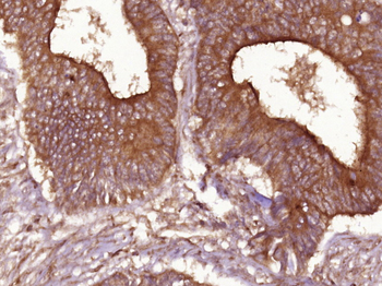 Cyclin D1 antibody