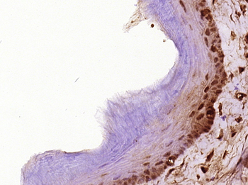 Cyclin D1 antibody